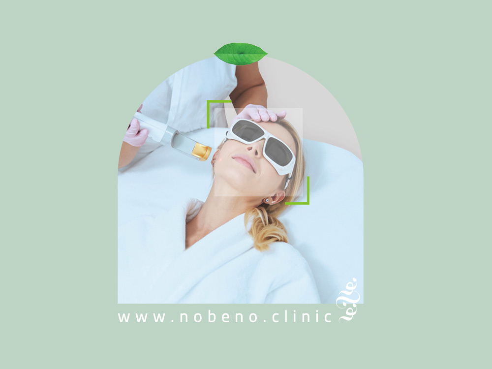 فرکشنال صورت